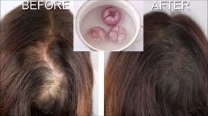 Onion For Hair Growth and hair problem